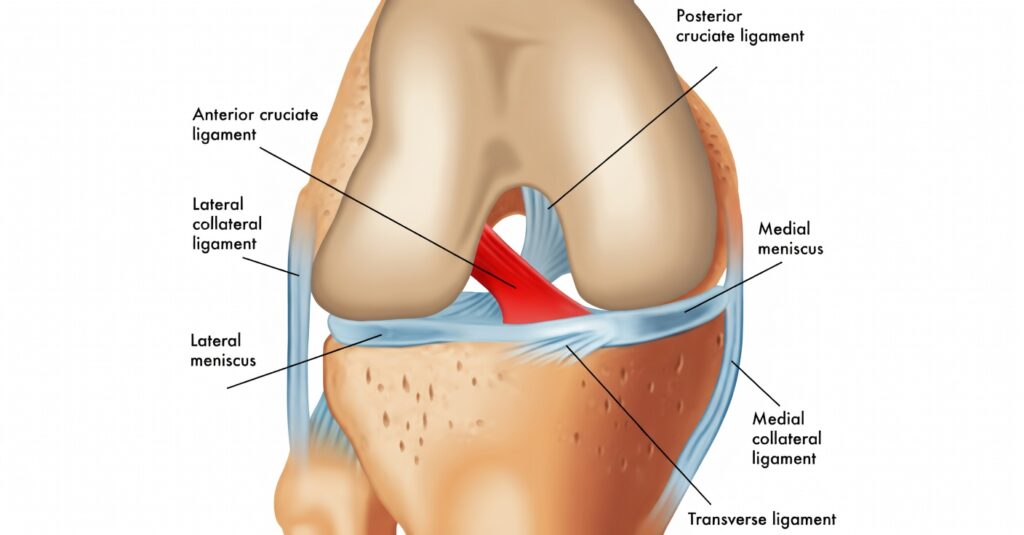 lca - Ligamento Cruzado Anterior